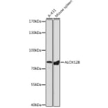 Western Blot - Anti-ALOX12B Antibody (A92046) - Antibodies.com