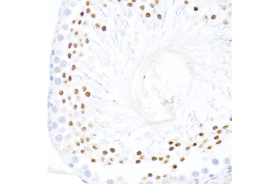 Immunohistochemistry - Anti-DDX59 Antibody (A92047) - Antibodies.com