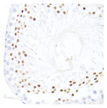 Immunohistochemistry - Anti-DDX59 Antibody (A92047) - Antibodies.com