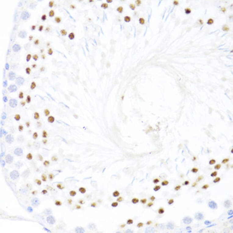Immunohistochemistry - Anti-DDX59 Antibody (A92047) - Antibodies.com