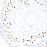 Immunohistochemistry - Anti-DDX59 Antibody (A92047) - Antibodies.com