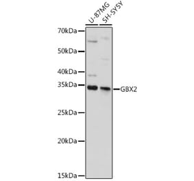 Western Blot - Anti-Gbx2 Antibody (A92048) - Antibodies.com