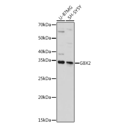 Western Blot - Anti-Gbx2 Antibody (A92048) - Antibodies.com