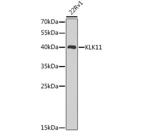 Western Blot - Anti-Kallikrein 11 Antibody (A92049) - Antibodies.com