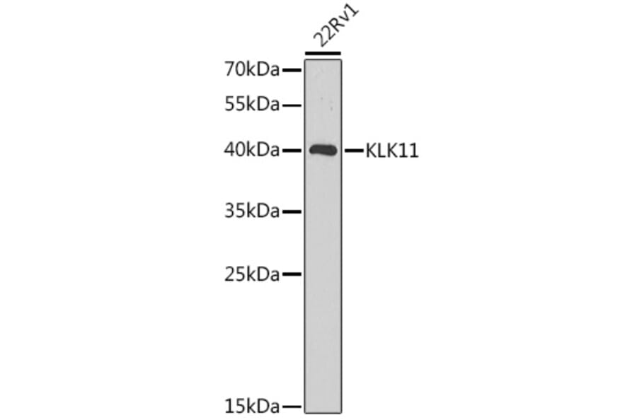 Western Blot - Anti-Kallikrein 11 Antibody (A92049) - Antibodies.com