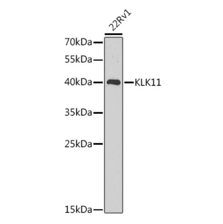Western Blot - Anti-Kallikrein 11 Antibody (A92049) - Antibodies.com