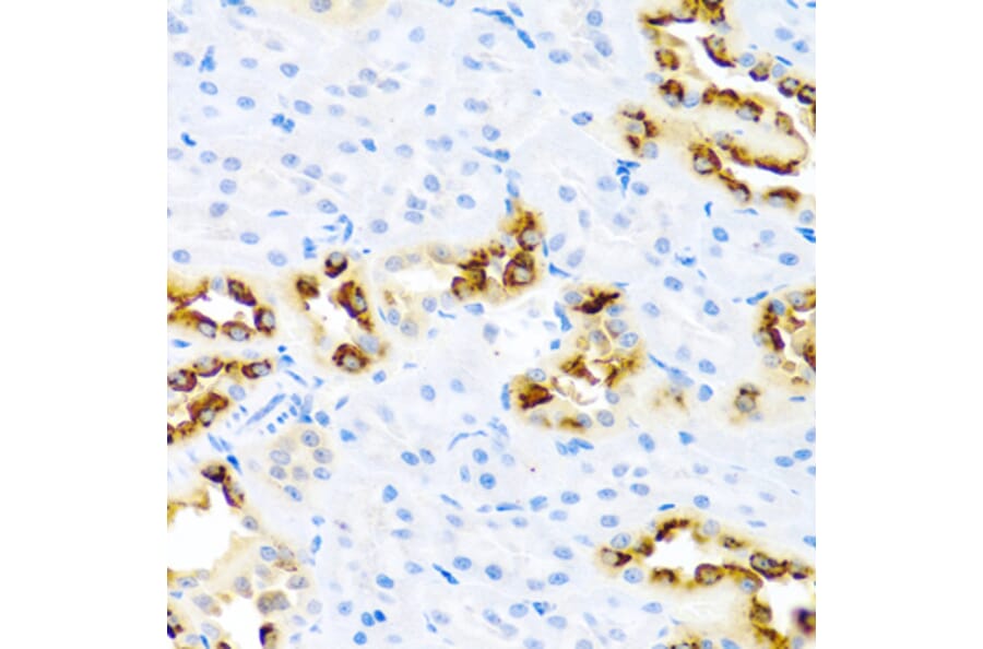 Immunohistochemistry - Anti-Kallikrein 11 Antibody (A92049) - Antibodies.com