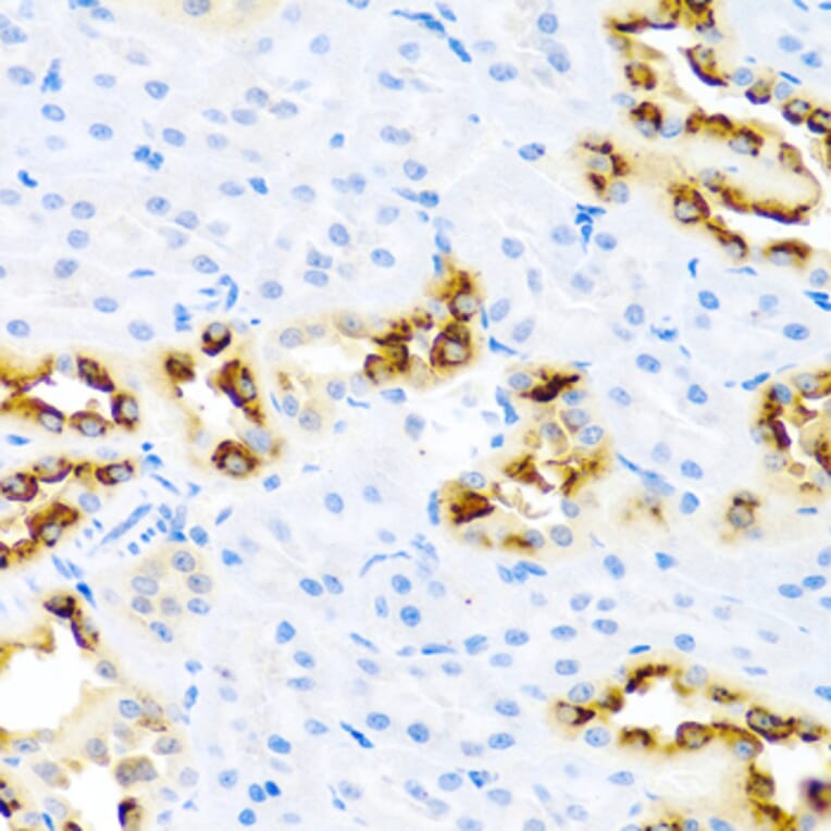 Immunohistochemistry - Anti-Kallikrein 11 Antibody (A92049) - Antibodies.com