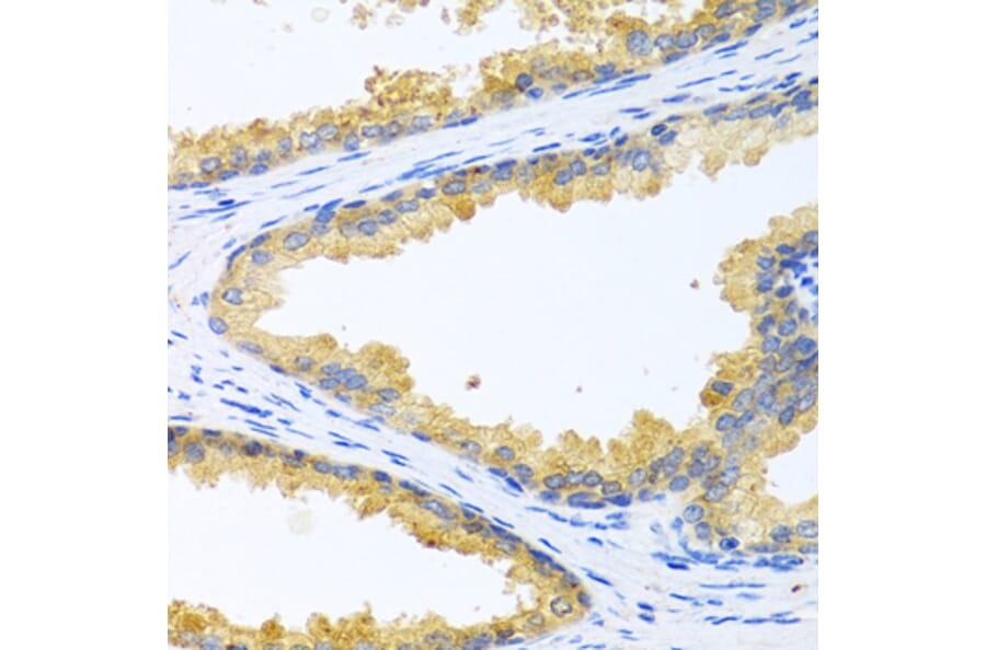 Immunohistochemistry - Anti-Kallikrein 11 Antibody (A92049) - Antibodies.com