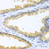 Immunohistochemistry - Anti-Kallikrein 11 Antibody (A92049) - Antibodies.com