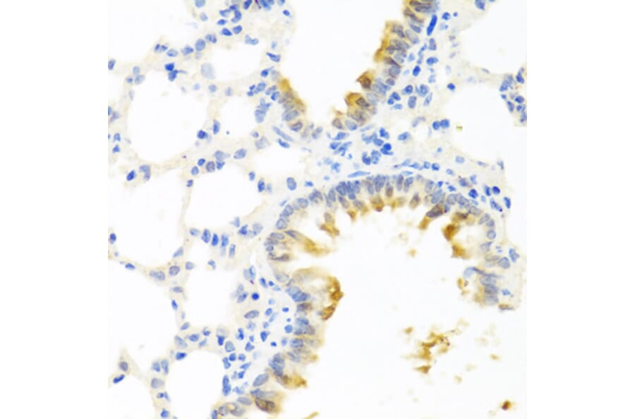 Immunohistochemistry - Anti-Kallikrein 11 Antibody (A92049) - Antibodies.com