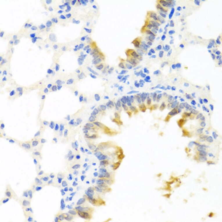 Immunohistochemistry - Anti-Kallikrein 11 Antibody (A92049) - Antibodies.com