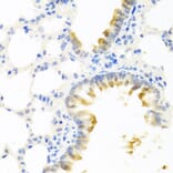 Immunohistochemistry - Anti-Kallikrein 11 Antibody (A92049) - Antibodies.com