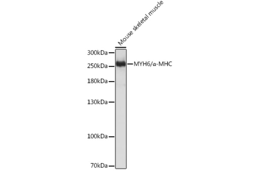 Western Blot - Anti-Myosin Antibody (A92050) - Antibodies.com