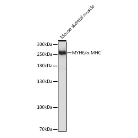 Western Blot - Anti-Myosin Antibody (A92050) - Antibodies.com