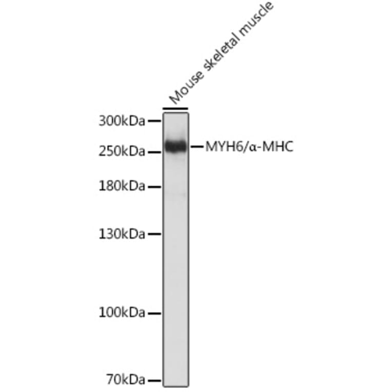 Western Blot - Anti-Myosin Antibody (A92050) - Antibodies.com