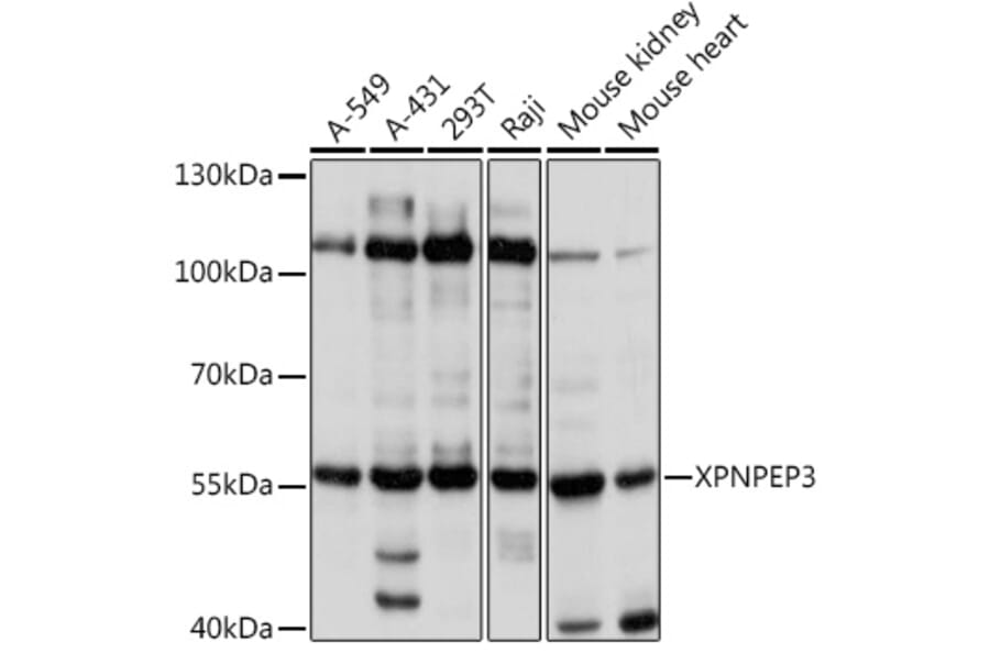 Western Blot - Anti-XPNPEP3 Antibody (A92053) - Antibodies.com