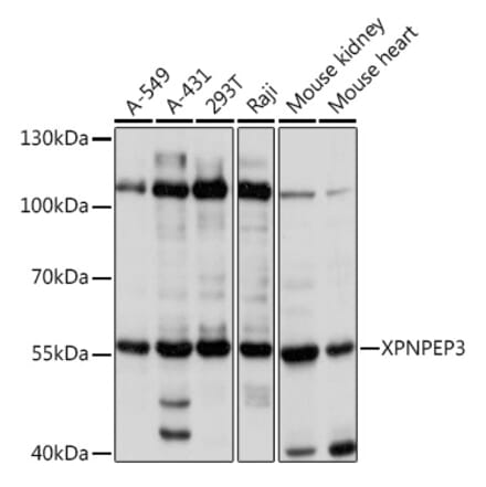Western Blot - Anti-XPNPEP3 Antibody (A92053) - Antibodies.com
