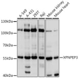 Western Blot - Anti-XPNPEP3 Antibody (A92053) - Antibodies.com