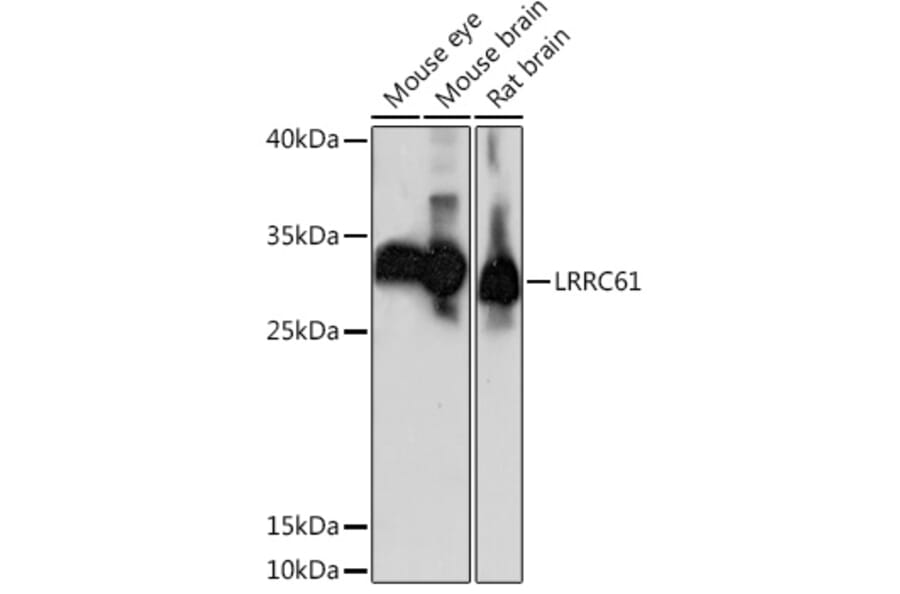 Western Blot - Anti-LRRC61 Antibody (A92055) - Antibodies.com