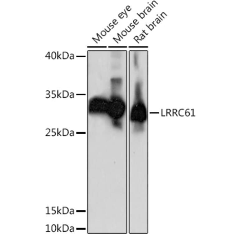 Western Blot - Anti-LRRC61 Antibody (A92055) - Antibodies.com