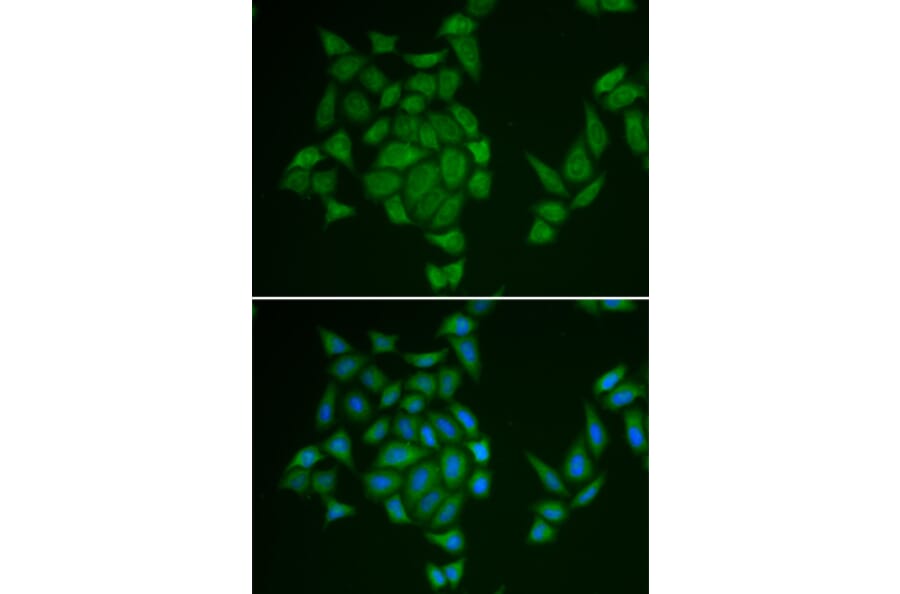Immunofluorescence - Anti-AMPD3 Antibody (A13464) - Antibodies.com
