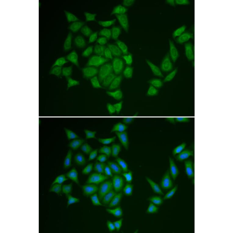 Immunofluorescence - Anti-AMPD3 Antibody (A13464) - Antibodies.com