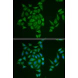 Immunofluorescence - Anti-AMPD3 Antibody (A13464) - Antibodies.com