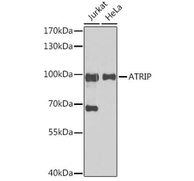 Western Blot - Anti-ATRIP Antibody (A92057) - Antibodies.com