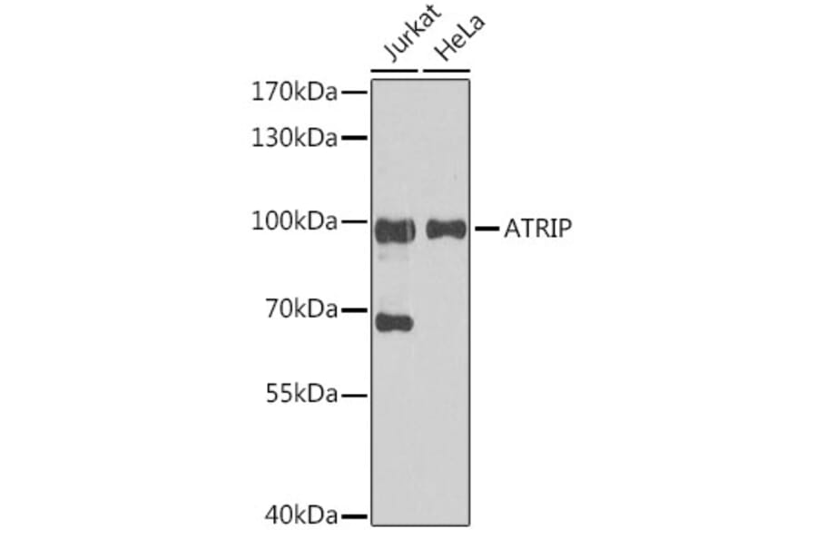 Western Blot - Anti-ATRIP Antibody (A92057) - Antibodies.com