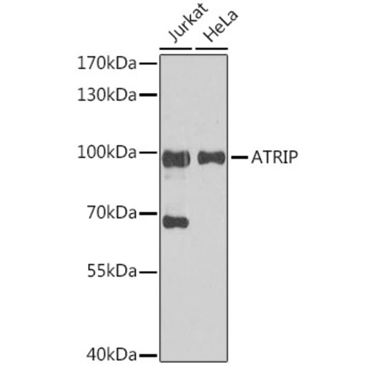 Western Blot - Anti-ATRIP Antibody (A92057) - Antibodies.com