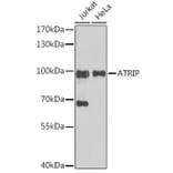 Western Blot - Anti-ATRIP Antibody (A92057) - Antibodies.com