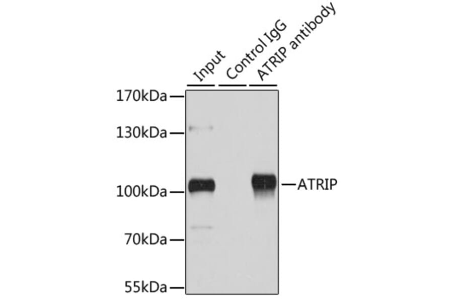 Western Blot - Anti-ATRIP Antibody (A92057) - Antibodies.com