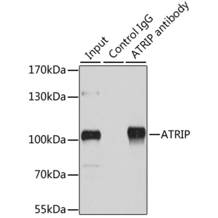 Western Blot - Anti-ATRIP Antibody (A92057) - Antibodies.com