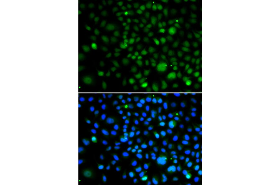 Immunofluorescence - Anti-KLF15 Antibody (A92059) - Antibodies.com