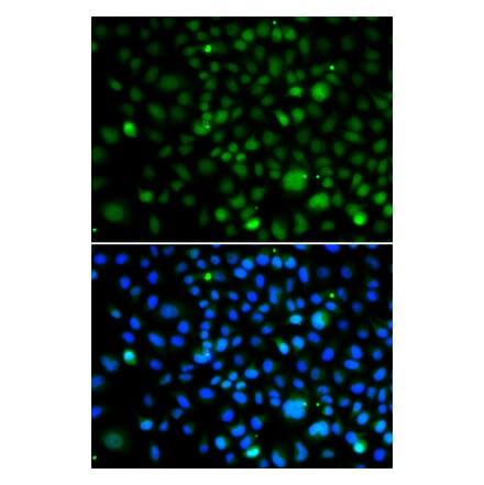 Immunofluorescence - Anti-KLF15 Antibody (A92059) - Antibodies.com