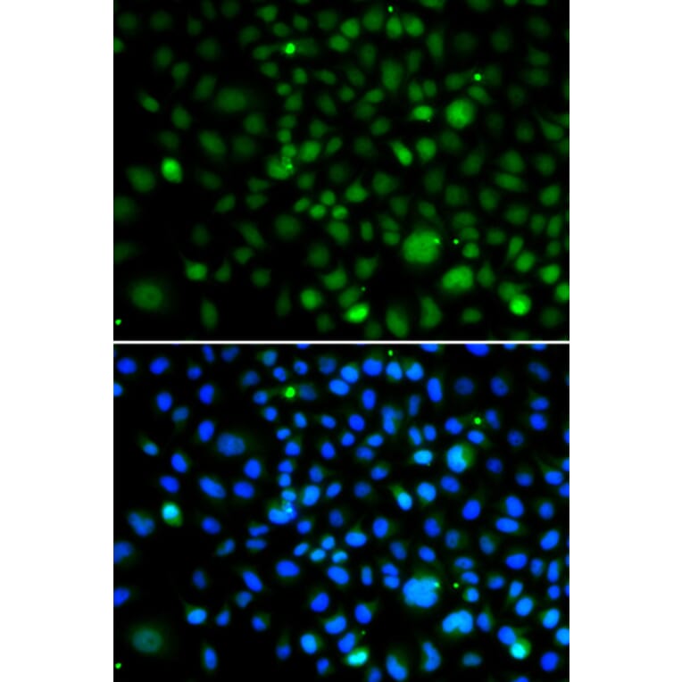 Immunofluorescence - Anti-KLF15 Antibody (A92059) - Antibodies.com