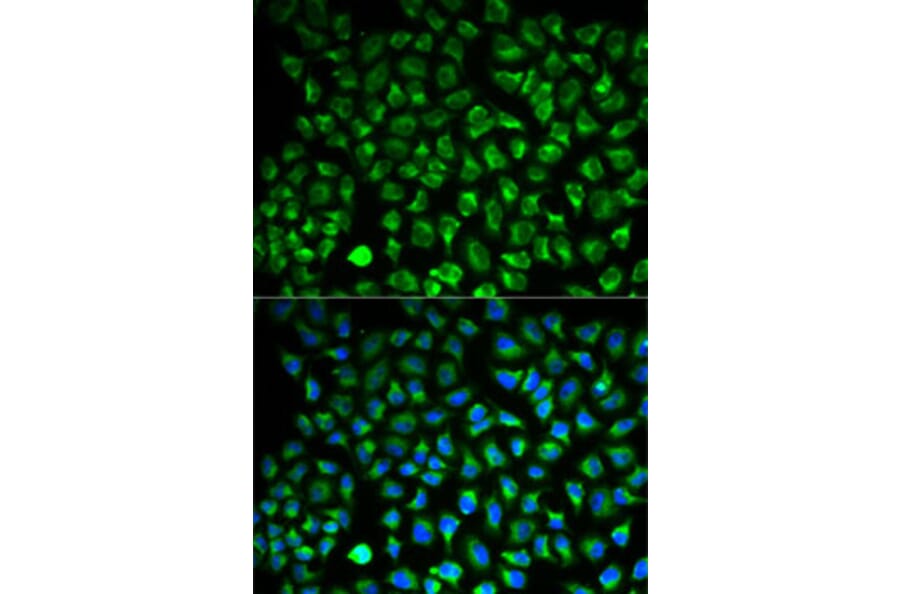 Immunofluorescence - Anti-MAO-A Antibody (A92060) - Antibodies.com