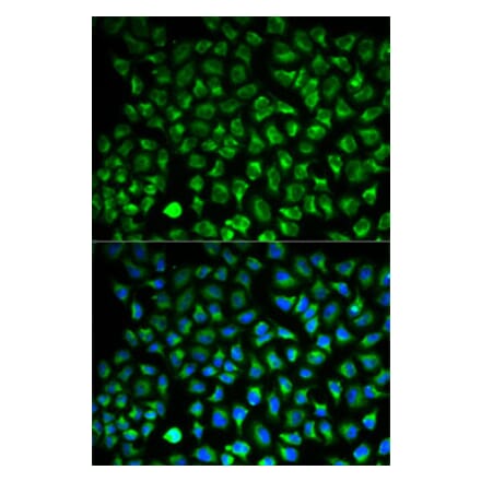 Immunofluorescence - Anti-MAO-A Antibody (A92060) - Antibodies.com