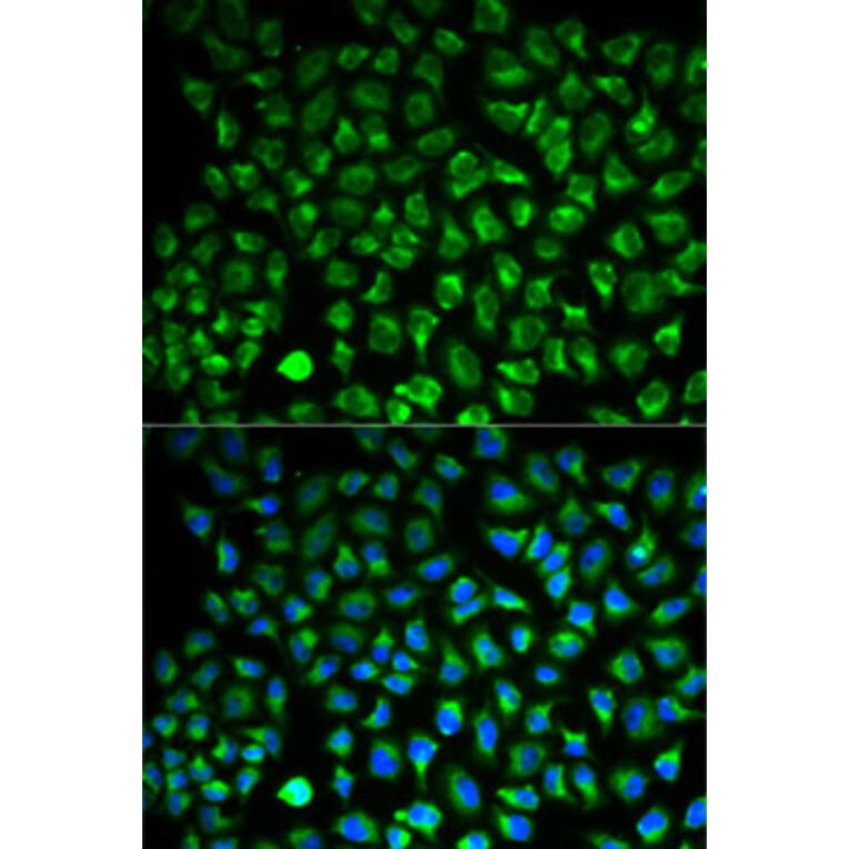 Immunofluorescence - Anti-MAO-A Antibody (A92060) - Antibodies.com