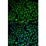 Immunofluorescence - Anti-MAO-A Antibody (A92060) - Antibodies.com
