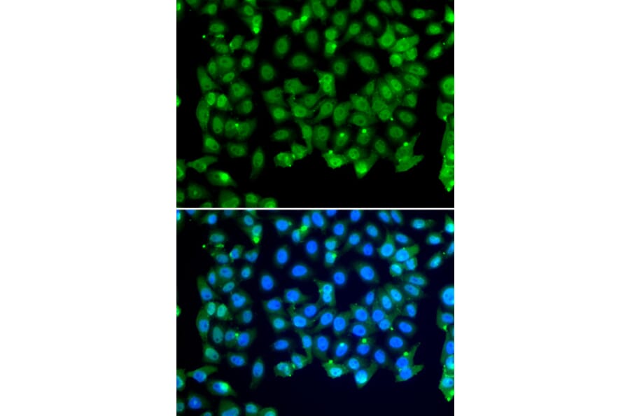 Immunofluorescence - Anti-RNF8 Antibody (A92061) - Antibodies.com
