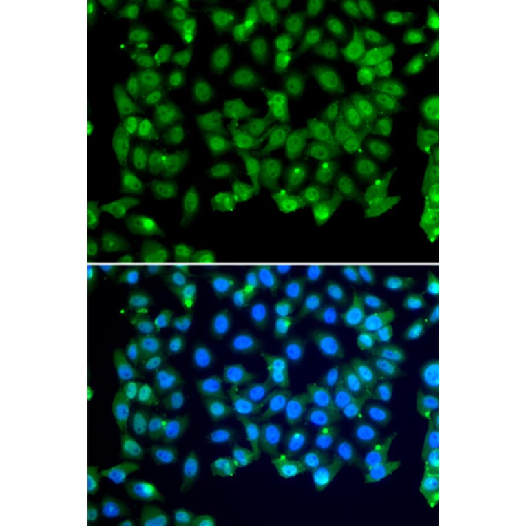 Immunofluorescence - Anti-RNF8 Antibody (A92061) - Antibodies.com