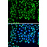 Immunofluorescence - Anti-RNF8 Antibody (A92061) - Antibodies.com