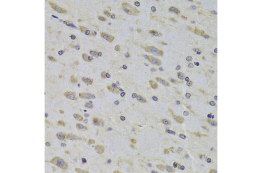 Immunohistochemistry - Anti-RPL3 Antibody (A14059) - Antibodies.com