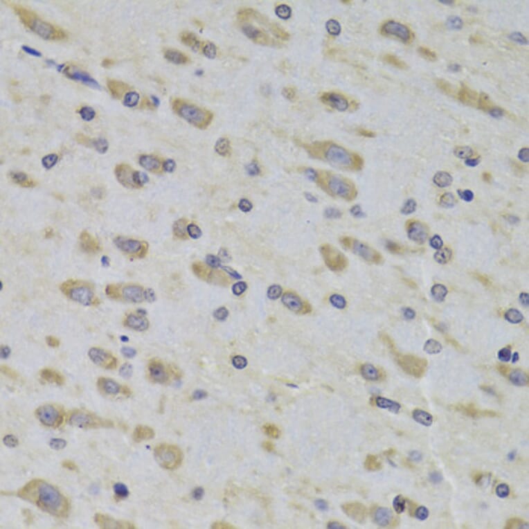 Immunohistochemistry - Anti-RPL3 Antibody (A14059) - Antibodies.com