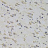 Immunohistochemistry - Anti-RPL3 Antibody (A14059) - Antibodies.com
