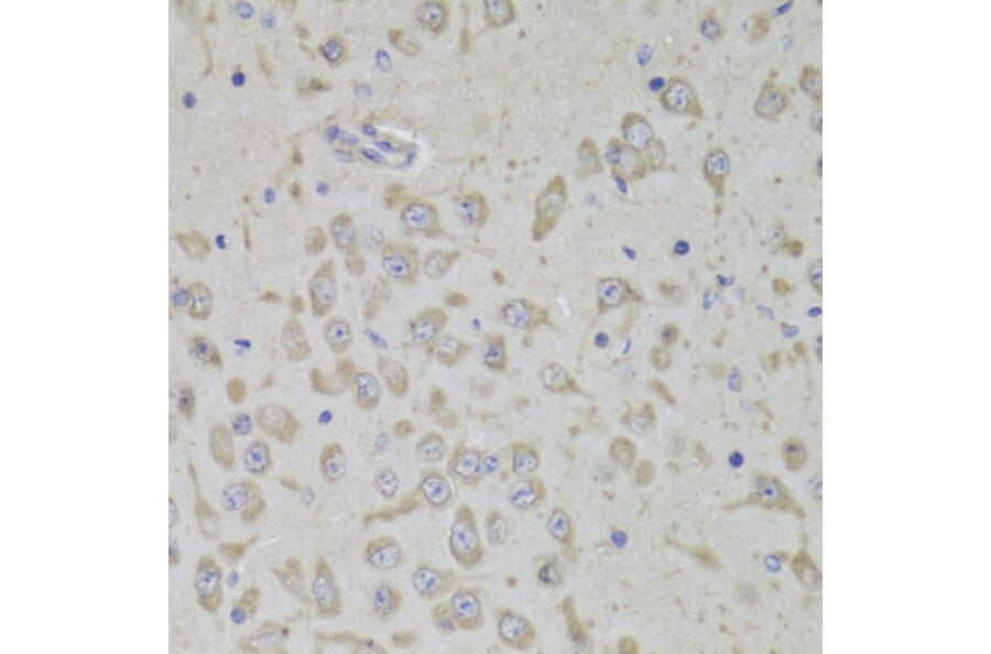 Immunohistochemistry - Anti-RPL3 Antibody (A14059) - Antibodies.com