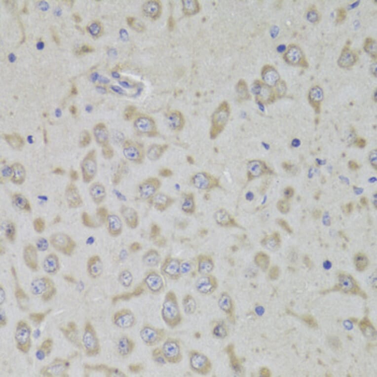 Immunohistochemistry - Anti-RPL3 Antibody (A14059) - Antibodies.com