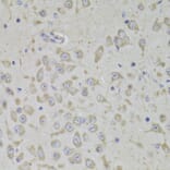 Immunohistochemistry - Anti-RPL3 Antibody (A14059) - Antibodies.com